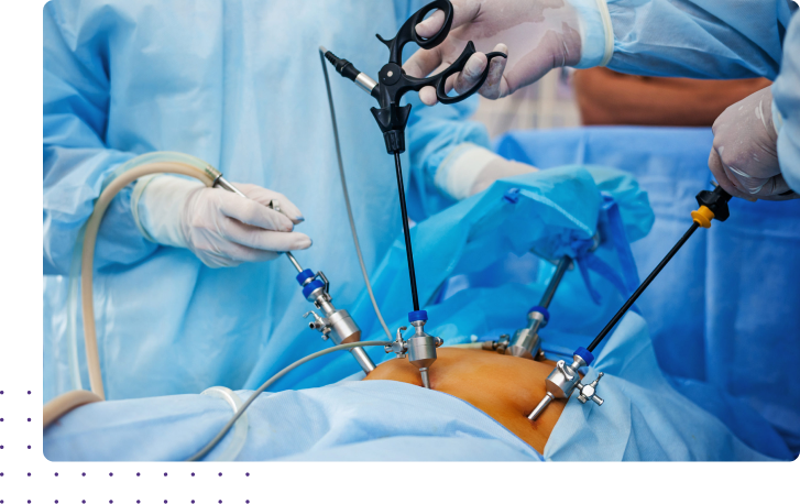 Liver Transplantation in Coimbatore